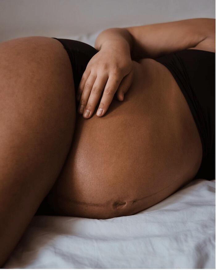 Le massage prénatal Technique de massage femme enceinte avec un gros ventre sur table